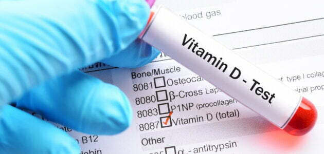 ما هي أعراض نقص فيتامين د Vitamin D Deficiency