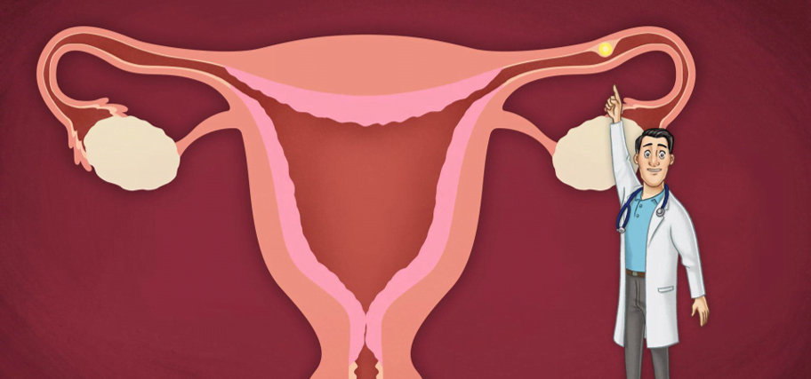 ما هي اعراض الحمل خارج الرحم