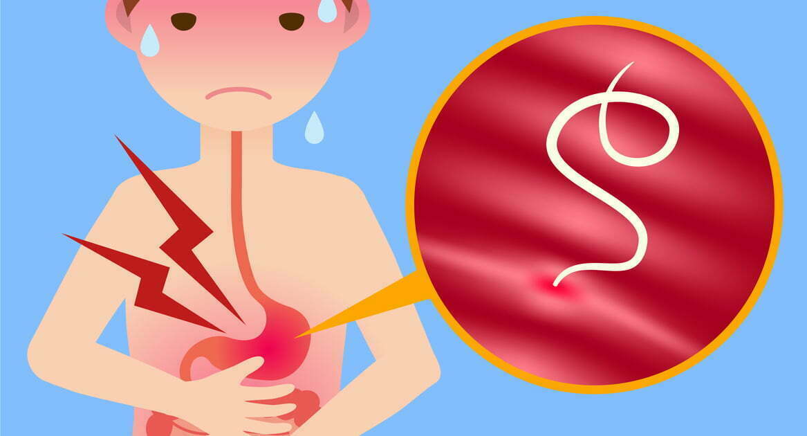 أعراض الإصابة بديدان البطن