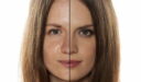 أسباب زيادة إفراز الدهون في الوجه وطرق علاجها