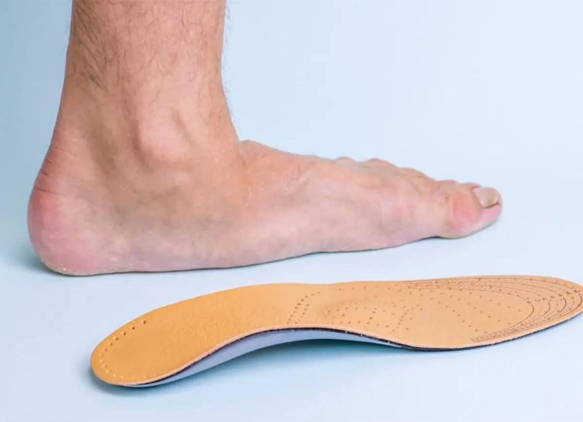 طرق علاج القدم المسطحة طبياً